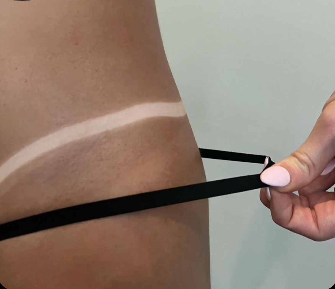 Crisp tan line on hip showing even, streak-free bronze from Brazilian oil.